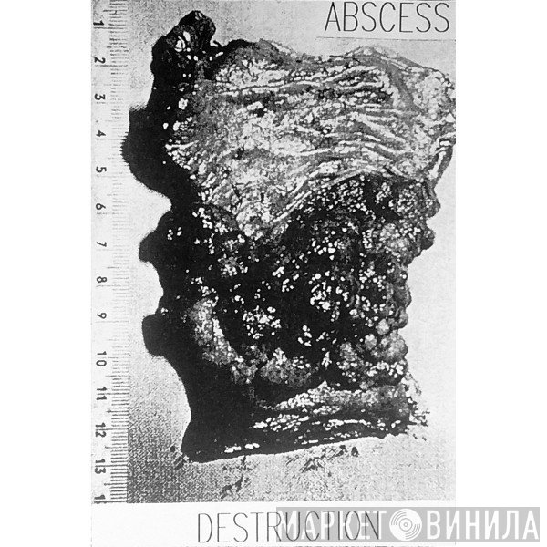 Abscess  - Destruction