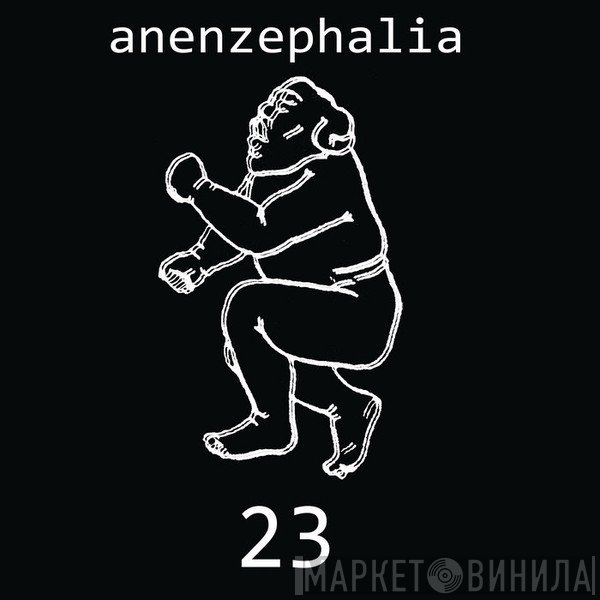 Anenzephalia  - 23