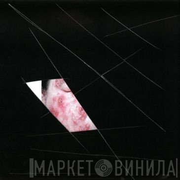 Atrax Morgue  - Fourth Injection
