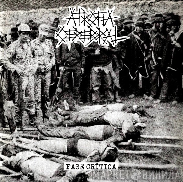 Atrofia Cerebral - Fase Crítica