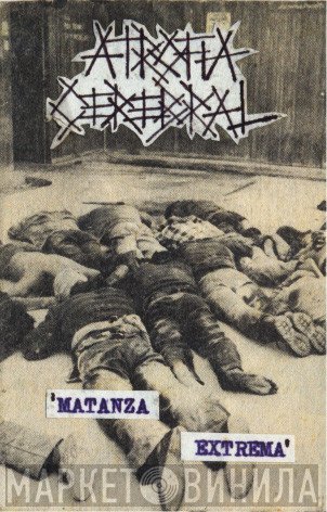 Atrofia Cerebral  - Matanza Extrema