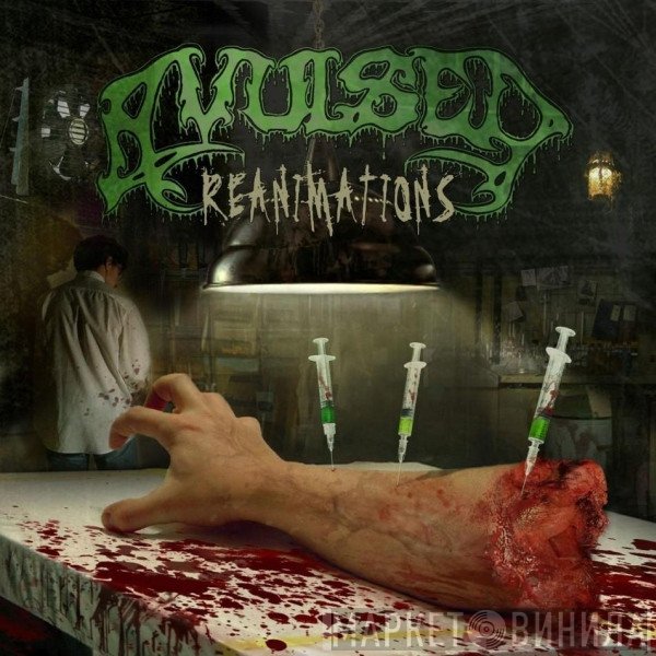 Avulsed  - Reanimations