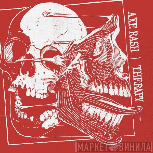 Axe Rash, Therapy   - Axe Rash / Therapy