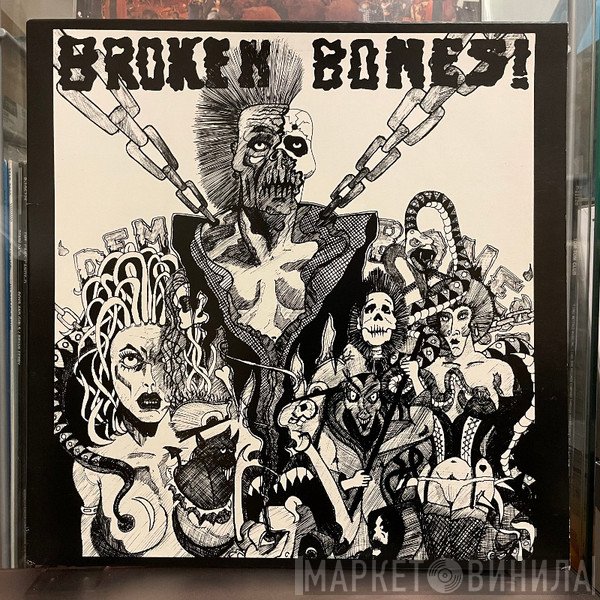 Broken Bones  - Dem Bones