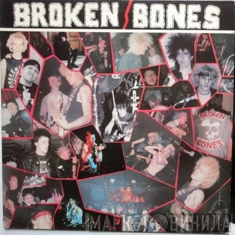 Broken Bones  - Never Say Die
