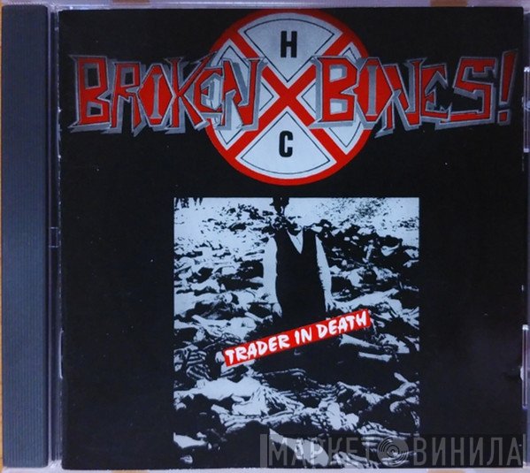 Broken Bones  - Trader In Death