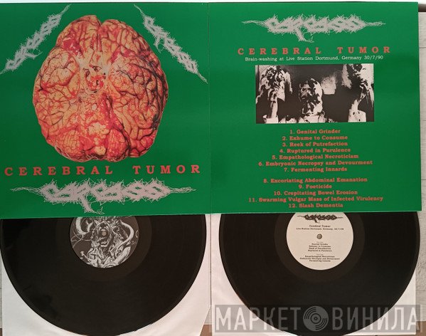 Carcass - Cerebral Tumor