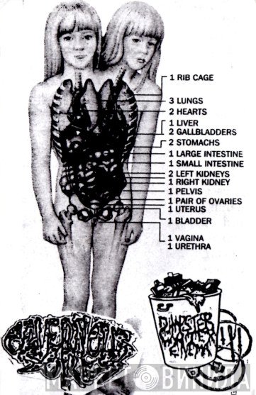Cavernous Sores, Dumpster Water Enema  - Split Tape