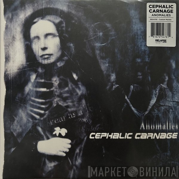 Cephalic Carnage - Anomalies
