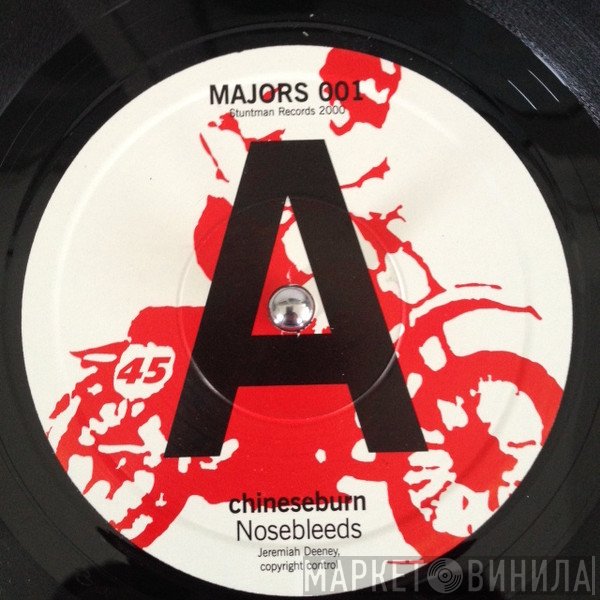 Chineseburn - Nosebleeds