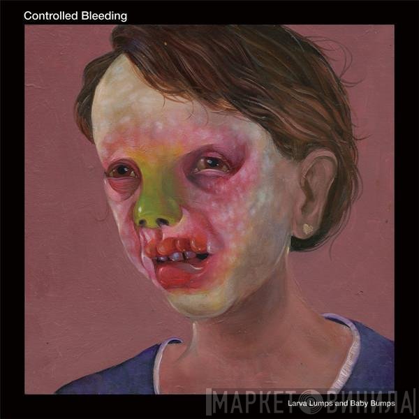 Controlled Bleeding - Larva Lumps And Baby Bumps