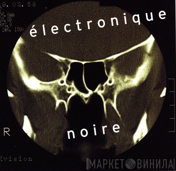 Eivind Aarset - Électronique Noire