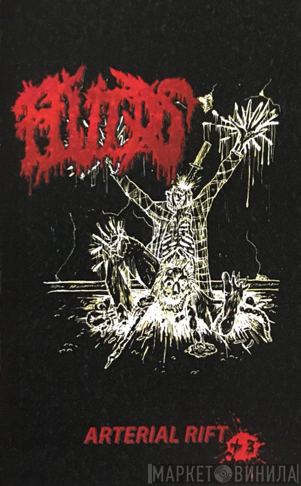 Fluids  - Arterial Rift +3