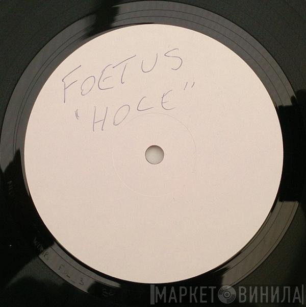 Foetus  - Hole