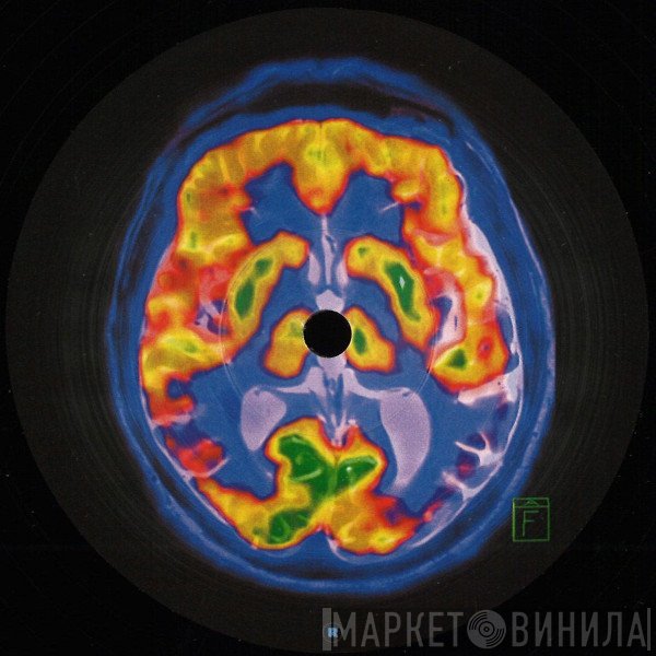 Frankey & Sandrino - Brainscan EP