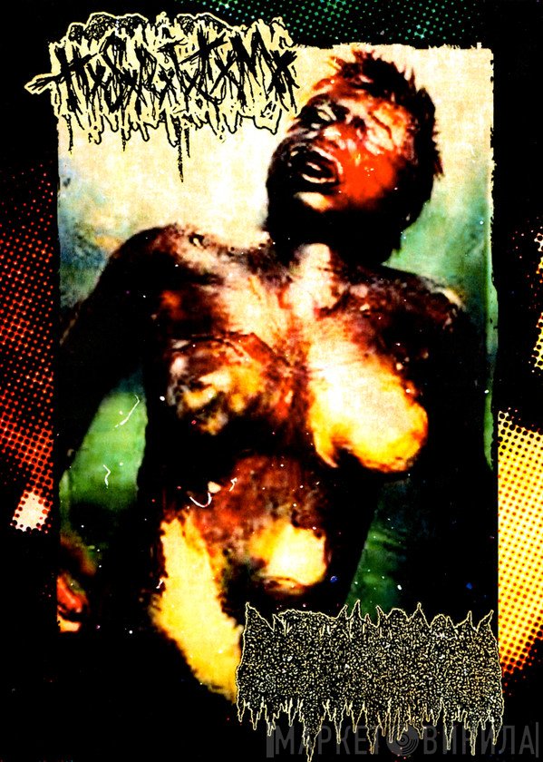 Human Stench Rests In The Morgue / Cystic Hygroma  - Split