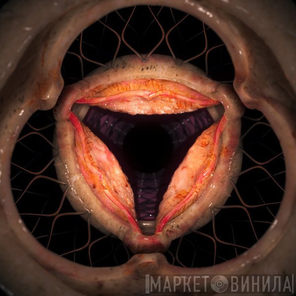 Hyph11E - Aperture
