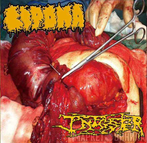 Lipoma / Infester   - Lipoma / Infester