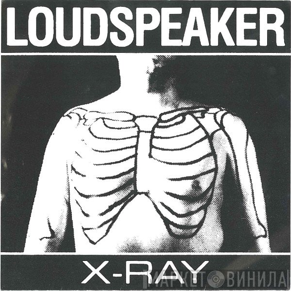 Loudspeaker - X-Ray