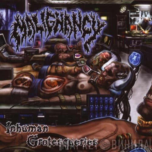 Malignancy  - Inhuman Grotesqueries