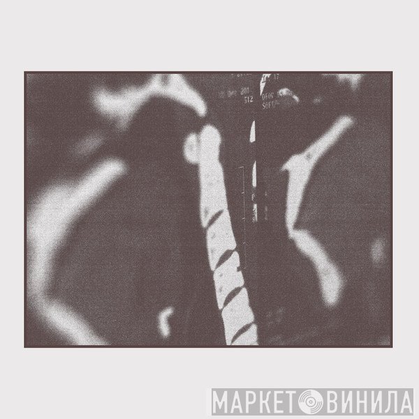 Norman Westberg - MRI