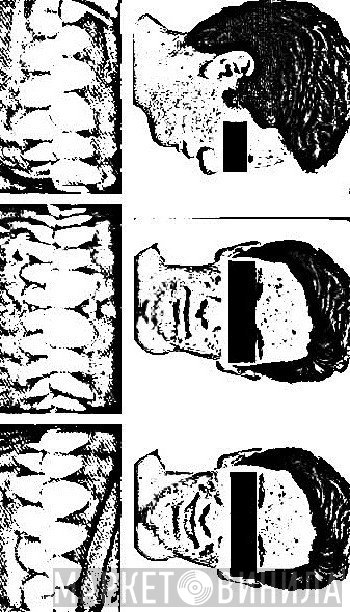 Overbite   - Demo 2013