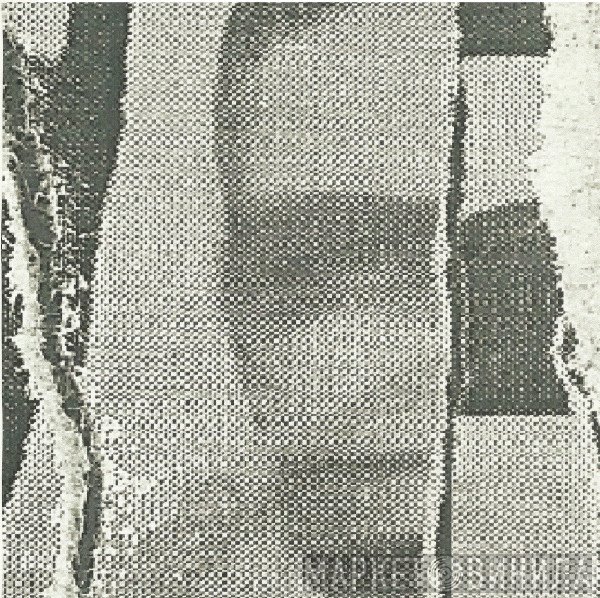 Overbite  - Overbite