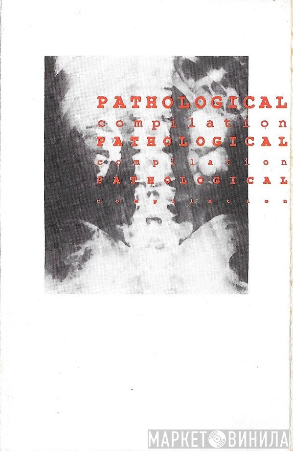  - Pathological Compilation