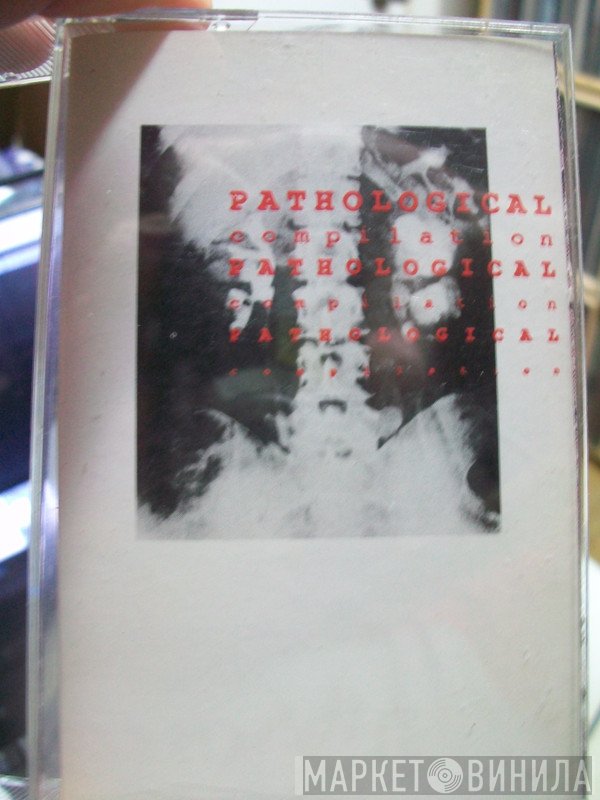  - Pathological Compilation