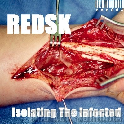 RedSK  - Isolating The Infected