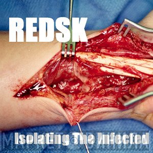 RedSK  - Isolating The Infected