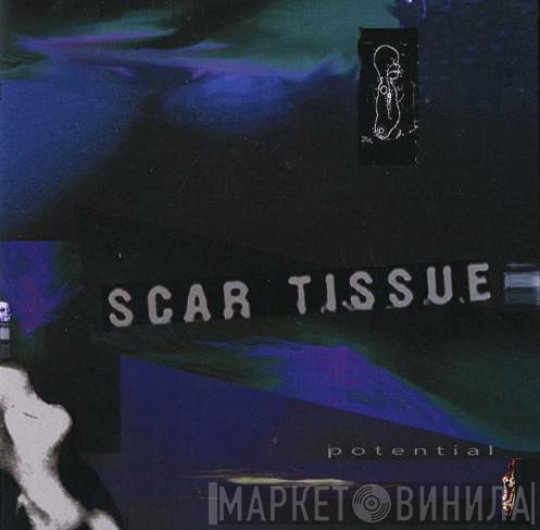 Scar Tissue  - Potential