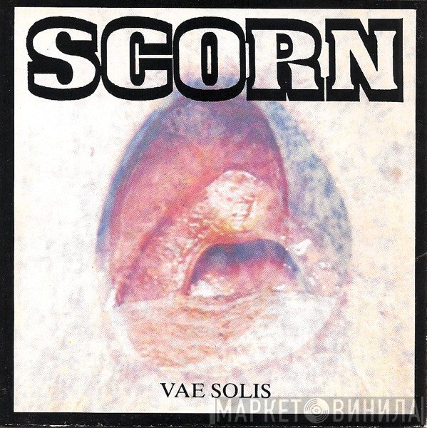Scorn - Vae Solis