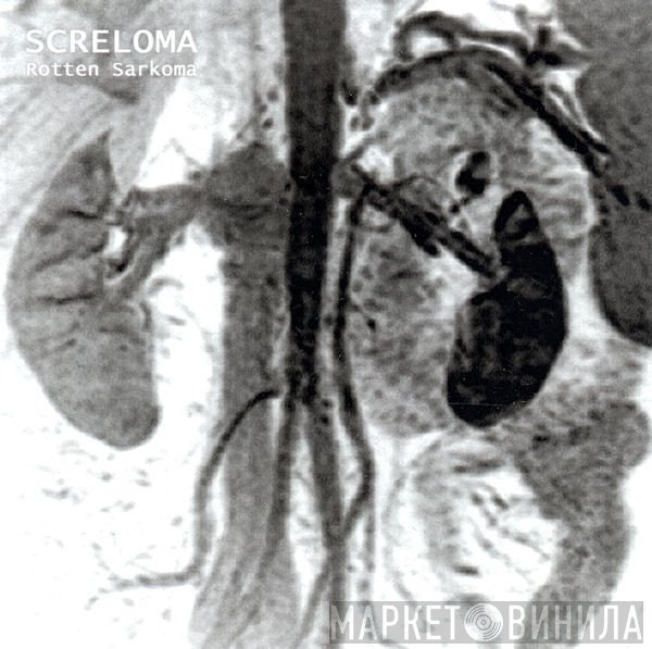 Screloma  - Rotten Sarkoma