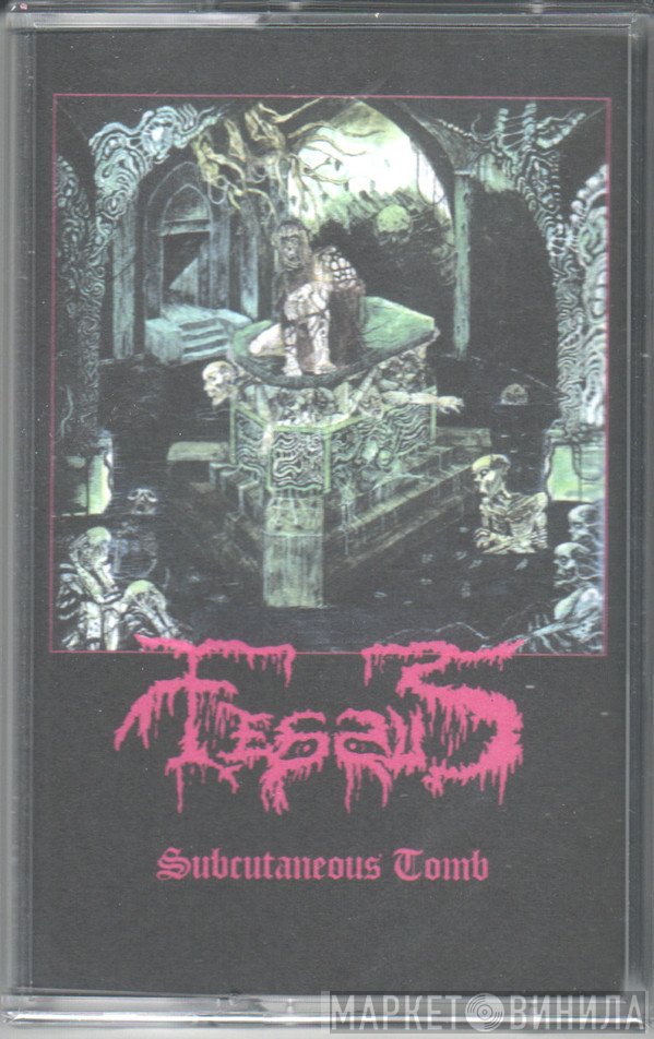  - Subcutaneous Tomb