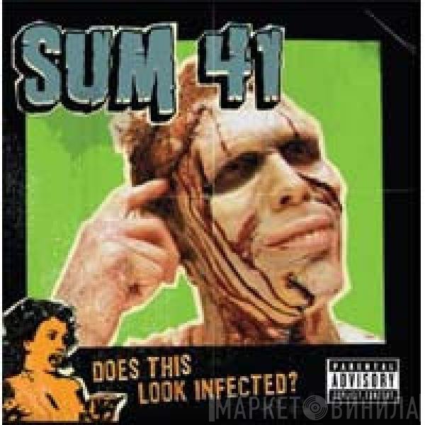 Sum 41  - Does This Look Infected?