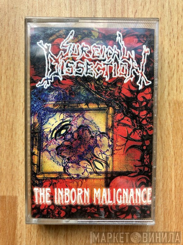 Surgical Dissection  - The Inborn Malignance