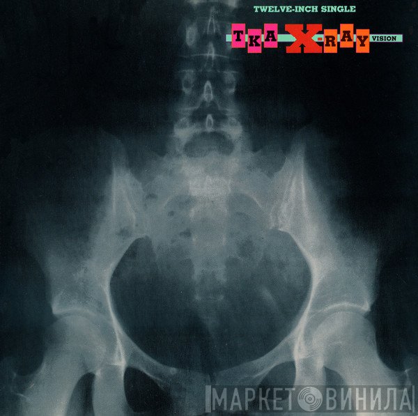 TKA  - X-Ray Vision