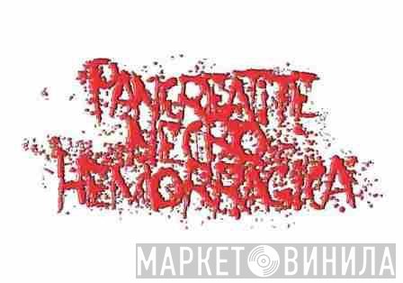 Pankreatite Necro Hemorrágica