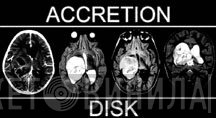 Accretion Disk - Винил CD и Кассеты лейбла Accretion Disk на сайте МаркетВинила