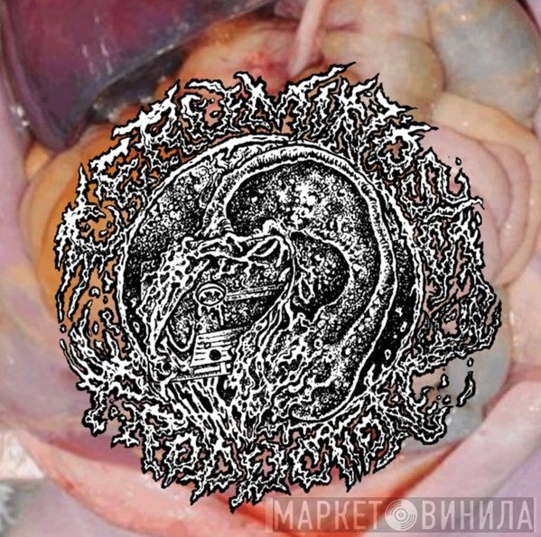 Ceruminosis Production - Винил CD и Кассеты лейбла Ceruminosis Production на сайте МаркетВинила